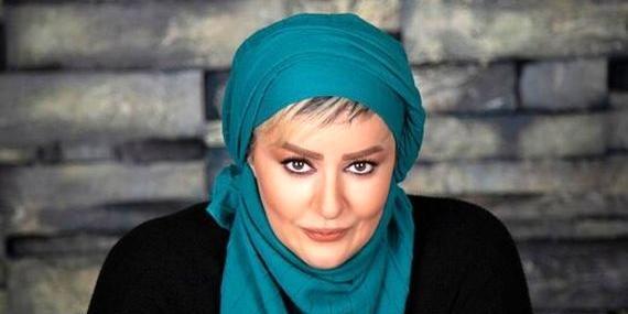 عکس ژاله صامتی بعد از عمل بینی