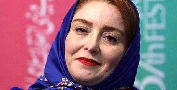 عکس ژاله صامتی بعد از عمل بینی