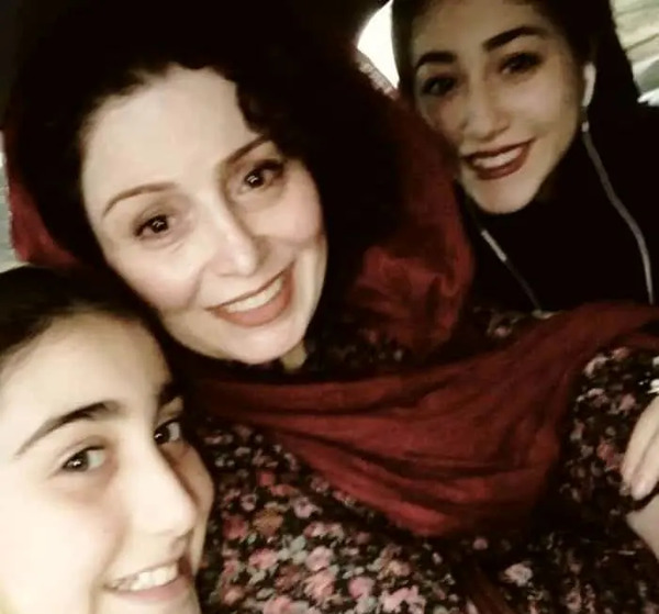 عکس ژاله صامتی بعد از عمل بینی