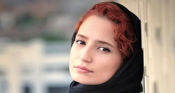 عکس ژاله صامتی بعد از عمل بینی