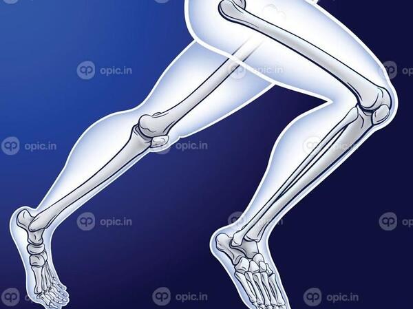 عکس سه بعدی اسکلت