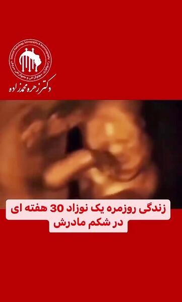 عکس جنین پسر سی هفته