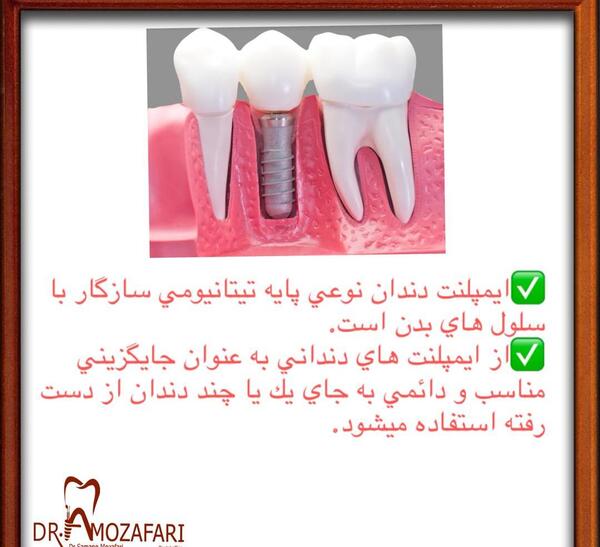 عکس سمانه مظفری