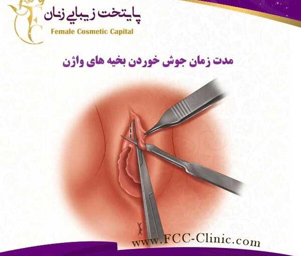 عکس جوش لبه داخلی واژن
