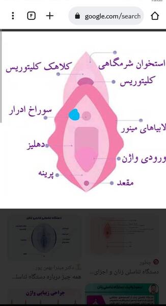 عکس جوش لبه داخلی واژن