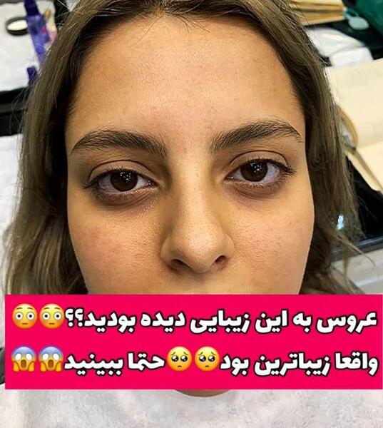 عکس بی آرایش ییلدیز