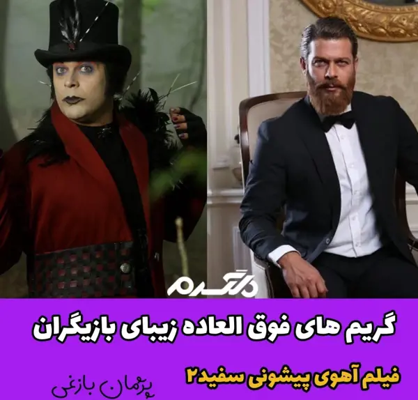 عکس بازیگر پیشونی سفید