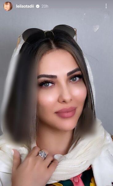 زشت ترین عکس لیلا اوتادی