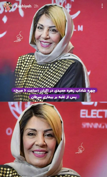 عکس های قدیمی زهره حمیدی