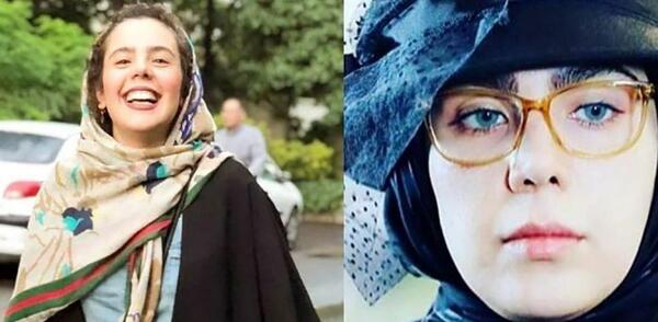 عکس ترسناک صورت زخمی در بچه مهندس