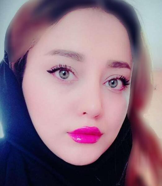 عکس ترسناک صورت زخمی در بچه مهندس