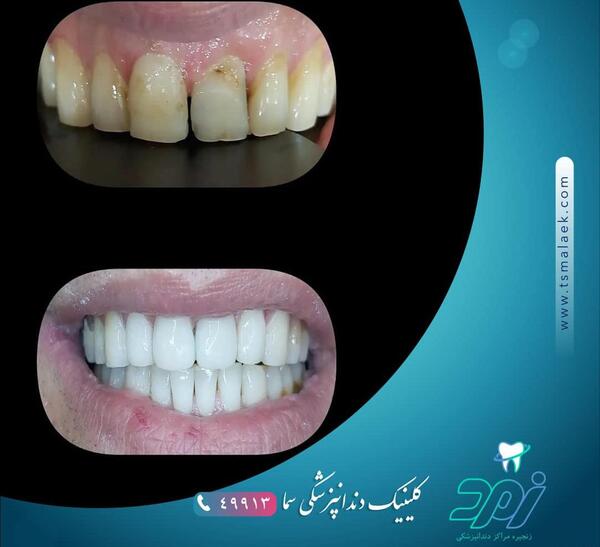 عکس برای سما