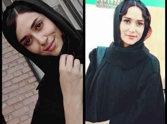 عکس پریناز ایزدیار قبل از عمل زیبایی