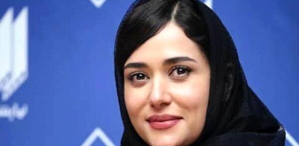 عکس پریناز ایزدیار قبل از عمل زیبایی