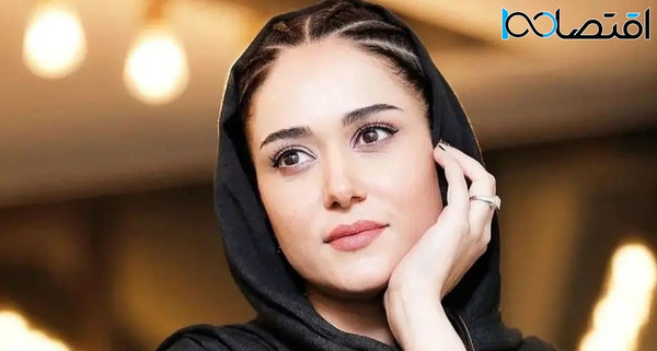عکس پریناز ایزدیار قبل از عمل زیبایی