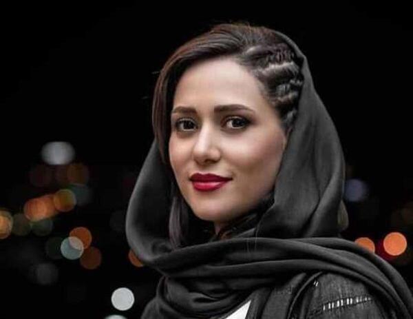 عکس پریناز ایزدیار قبل از عمل زیبایی