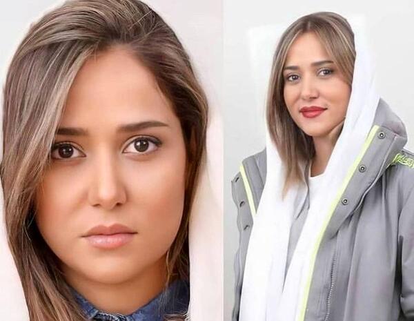 عکس پریناز ایزدیار قبل از عمل زیبایی
