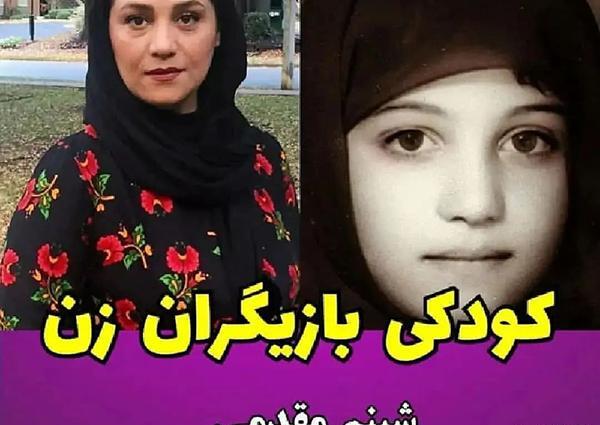 عکس پریناز ایزدیار قبل از عمل زیبایی