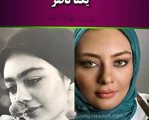 عکس پریناز ایزدیار قبل از عمل زیبایی