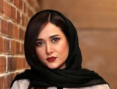 عکس پریناز ایزدیار قبل از عمل زیبایی