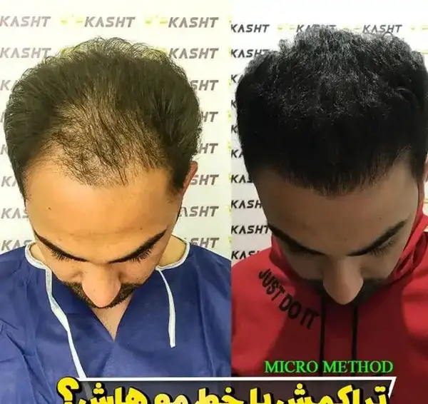 عکس محمد قلی مو