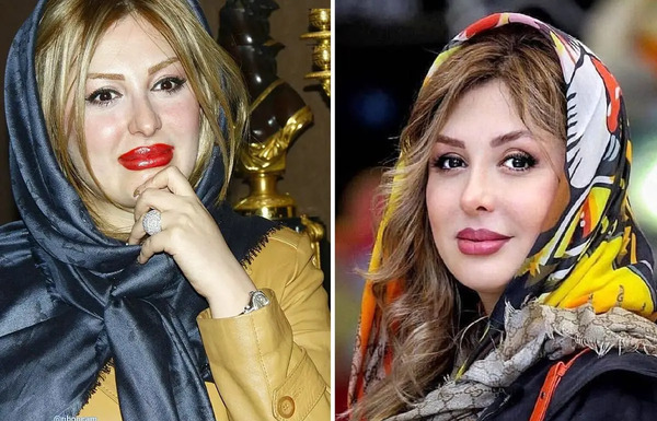 عکس های سوسانو قبل از عمل
