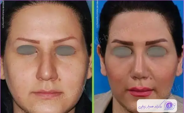 عکس جلیل بشارتی