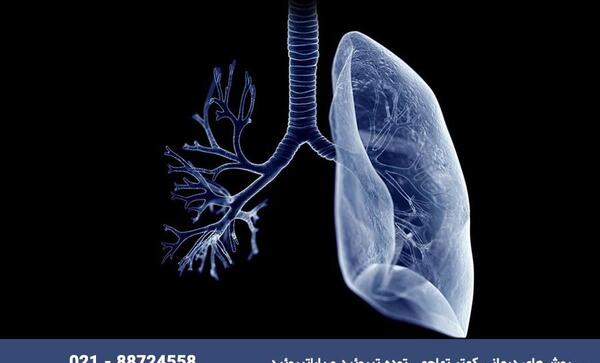 عکس ریه های فرد کرونایی