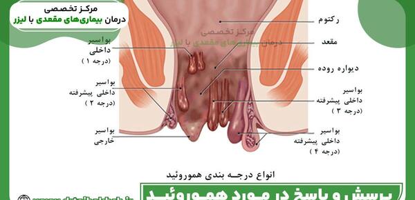 عکس فیبروم دفع شده نی نی سایت