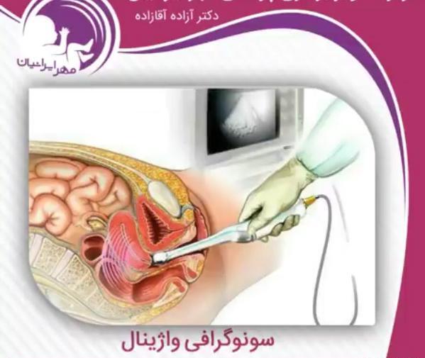 عکس واقعی رحم