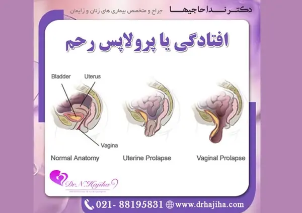 عکس واقعی رحم