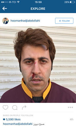 عکس مرد صورت