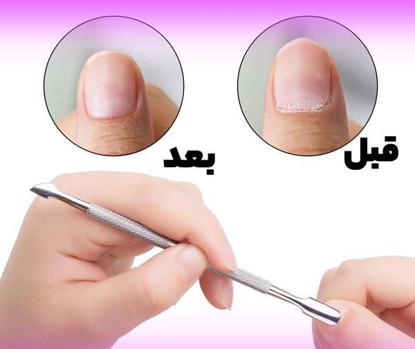 عکس ژلیش ناخن قبل و بعد