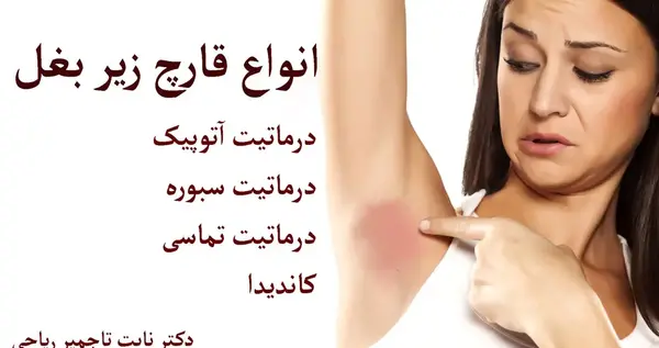 عکس سفیدی زیر بغل
