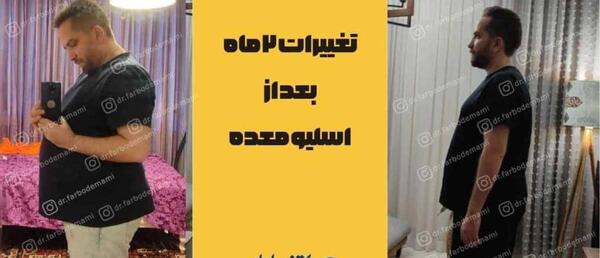 عکس قبل و بعد چاقی