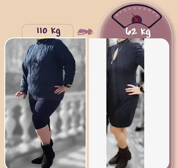 عکس قبل و بعد چاقی
