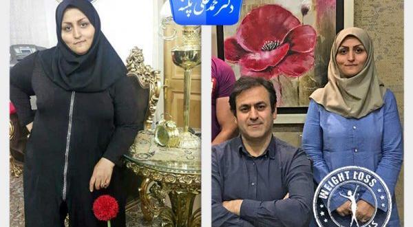 عکس قبل و بعد چاقی