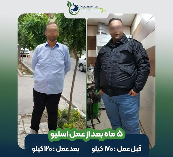 عکس قبل و بعد چاقی
