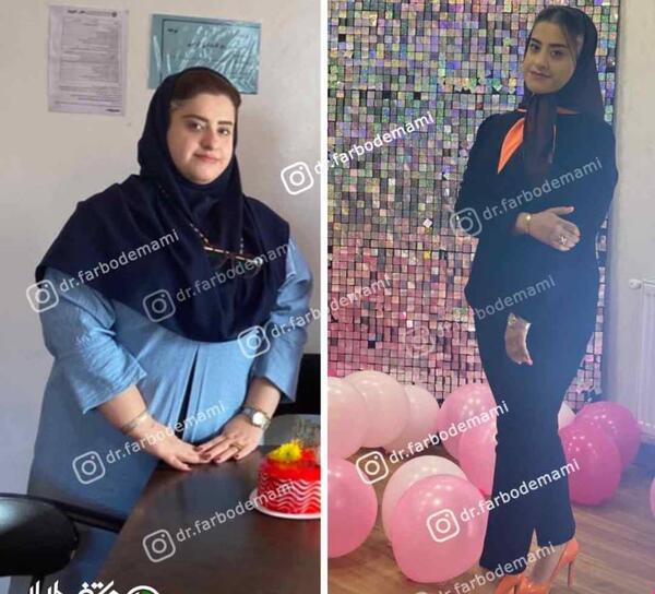 عکس قبل و بعد چاقی