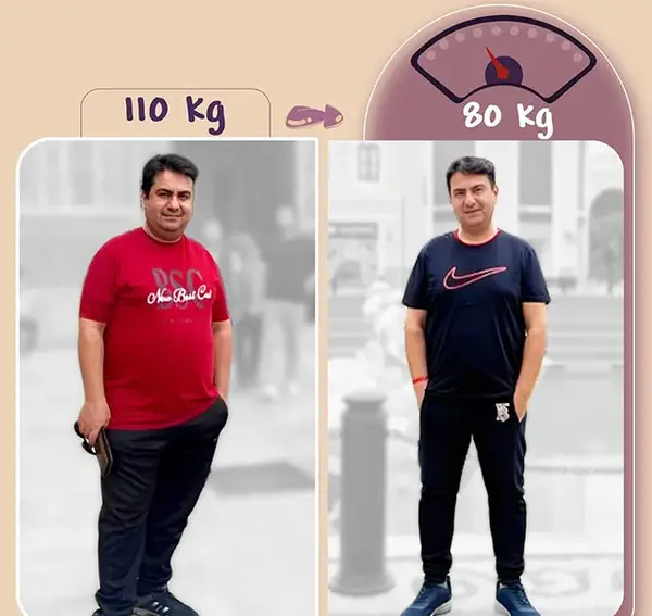 عکس قبل و بعد چاقی