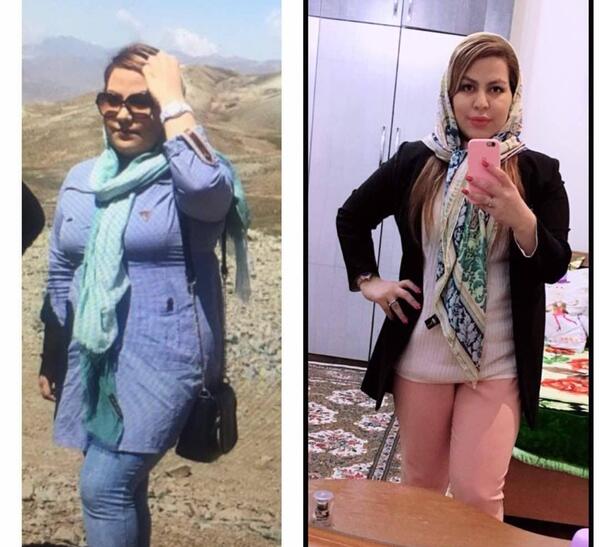 عکس قبل و بعد چاقی
