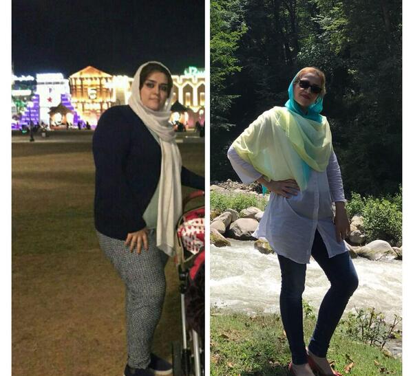 عکس قبل و بعد چاقی