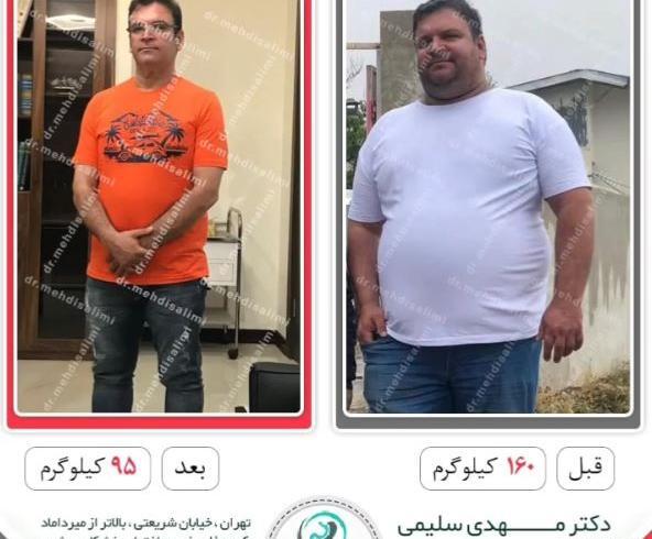 عکس قبل و بعد چاقی