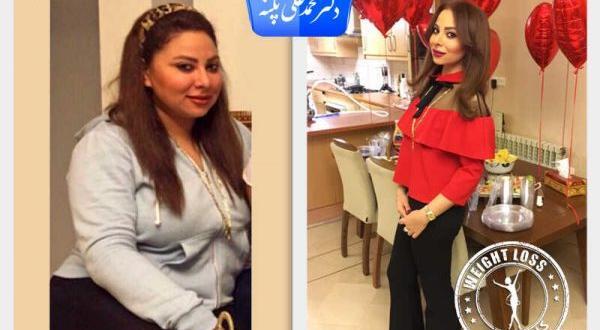 عکس قبل و بعد چاقی