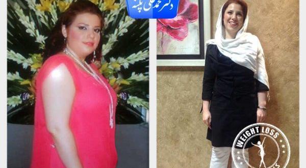 عکس قبل و بعد چاقی