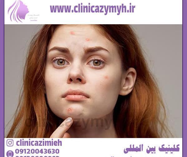عکس جاهای مختلف صورت