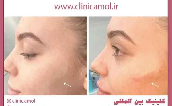 عکس جاهای مختلف صورت