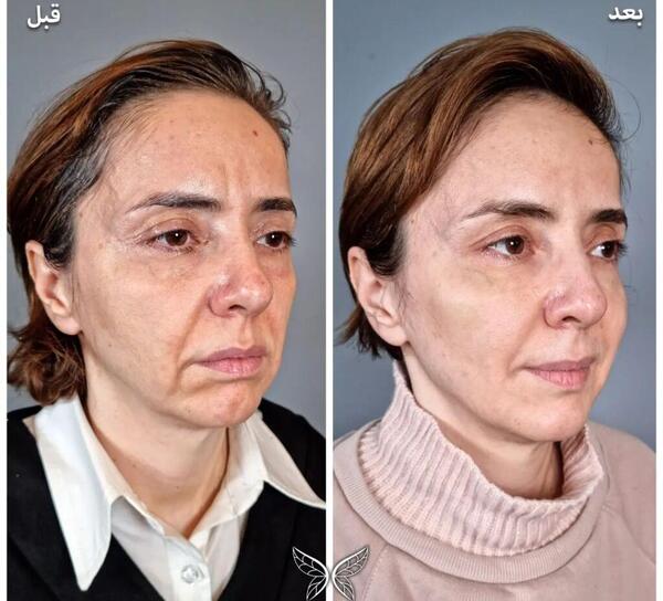 عکس جاهای مختلف صورت