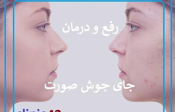 عکس جاهای مختلف صورت