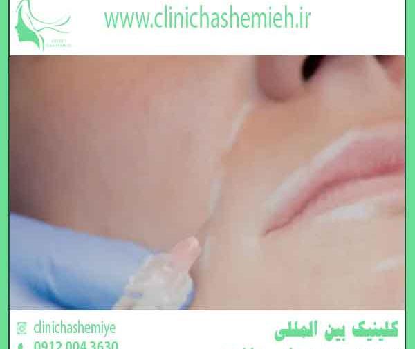 عکس جاهای مختلف صورت